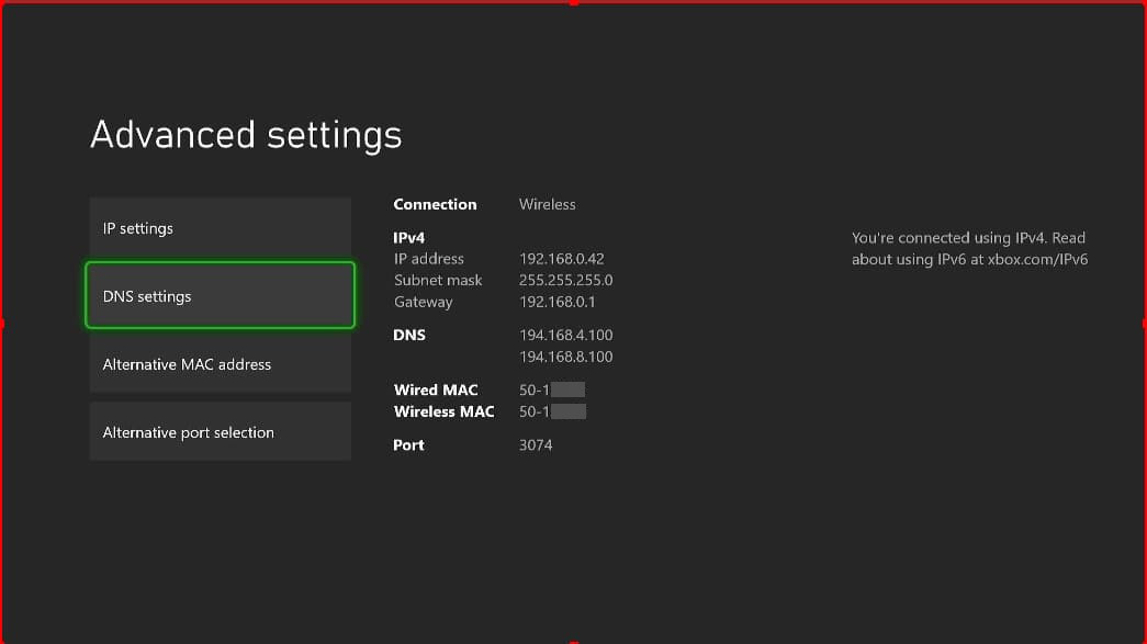 Xbox One IP Address